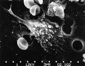 Cells go out with a bang not a whimper