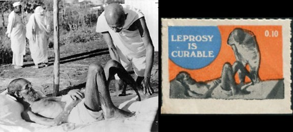 Mahatma Gandhi nursing the leper patient Parchure Shastri, Sevagram Ashram, 1939. Mahatma Gandhi bei der Behandlung des Lepra-Patienten Parchure Shastri im Sevagram-Aschram, 1939.